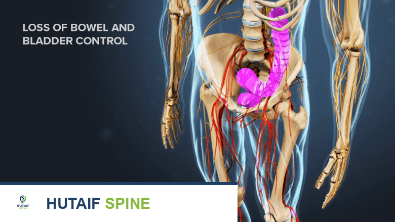 آلام الظهر العلوية: الأعراض، الأسباب، والحلول الفعالة مع الأستاذ الدكتور محمد هطيف