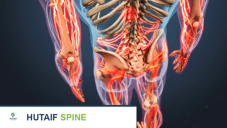 تضيق القناة الشوكية: دليل شامل من الأستاذ الدكتور محمد هطيف في صنعاء