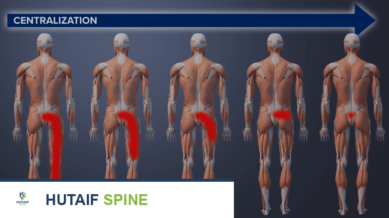طريقة ماكنزي للعلاج: دليل شامل لآلام الظهر والرقبة وعرق النسا من الأستاذ الدكتور محمد هطيف