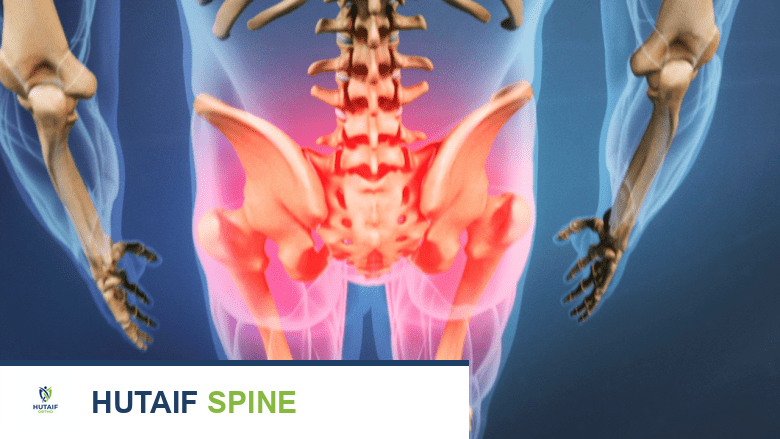 رسم توضيحي يظهر منطقة حمراء حول الحوض والفخذين