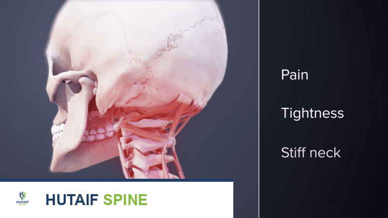 متى يستدعي تصلب الرقبة القلق؟ دليل شامل من الأستاذ الدكتور محمد هطيف