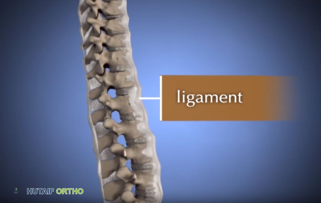 الودانة (التقزم الغضروفي): دليل شامل للمرضى مع الأستاذ الدكتور محمد هطيف