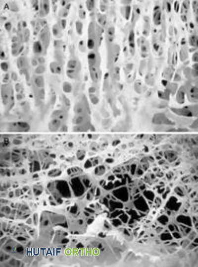 صورة توضيحية لـ صحة العظام الأساسية: دليلك الشامل لوقاية وعلاج هشاشة العظام مع الأستاذ الدكتور محمد هطيف