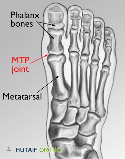 تشريح القدم الطبيعي