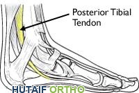 تشريح القدم الطبيعي