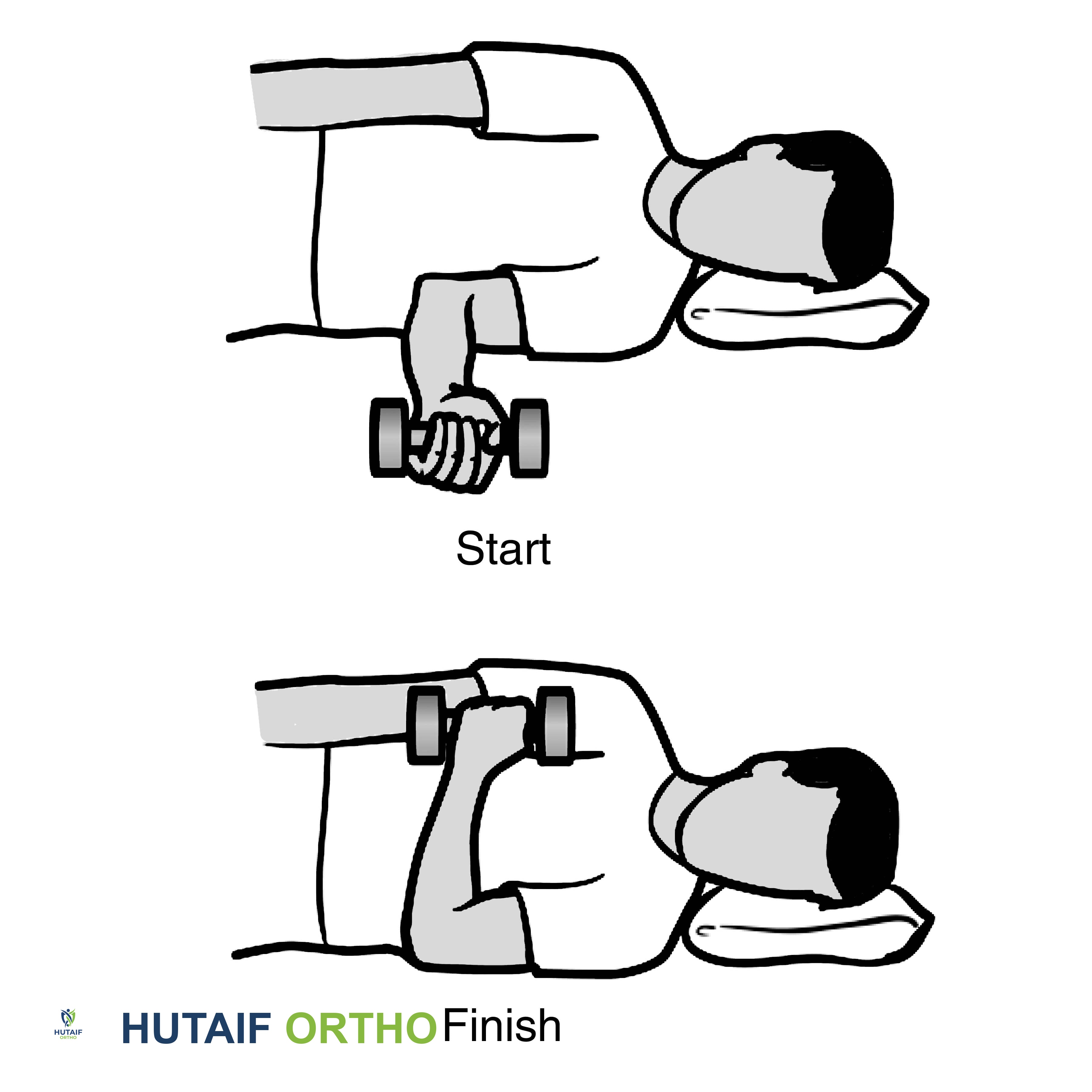 صورة طبية: تمزق الكفة المدورة بالكتف: دليلك الشامل للعلاج والتعافي مع الأستاذ الدكتور محمد هطيف في صنعاء
