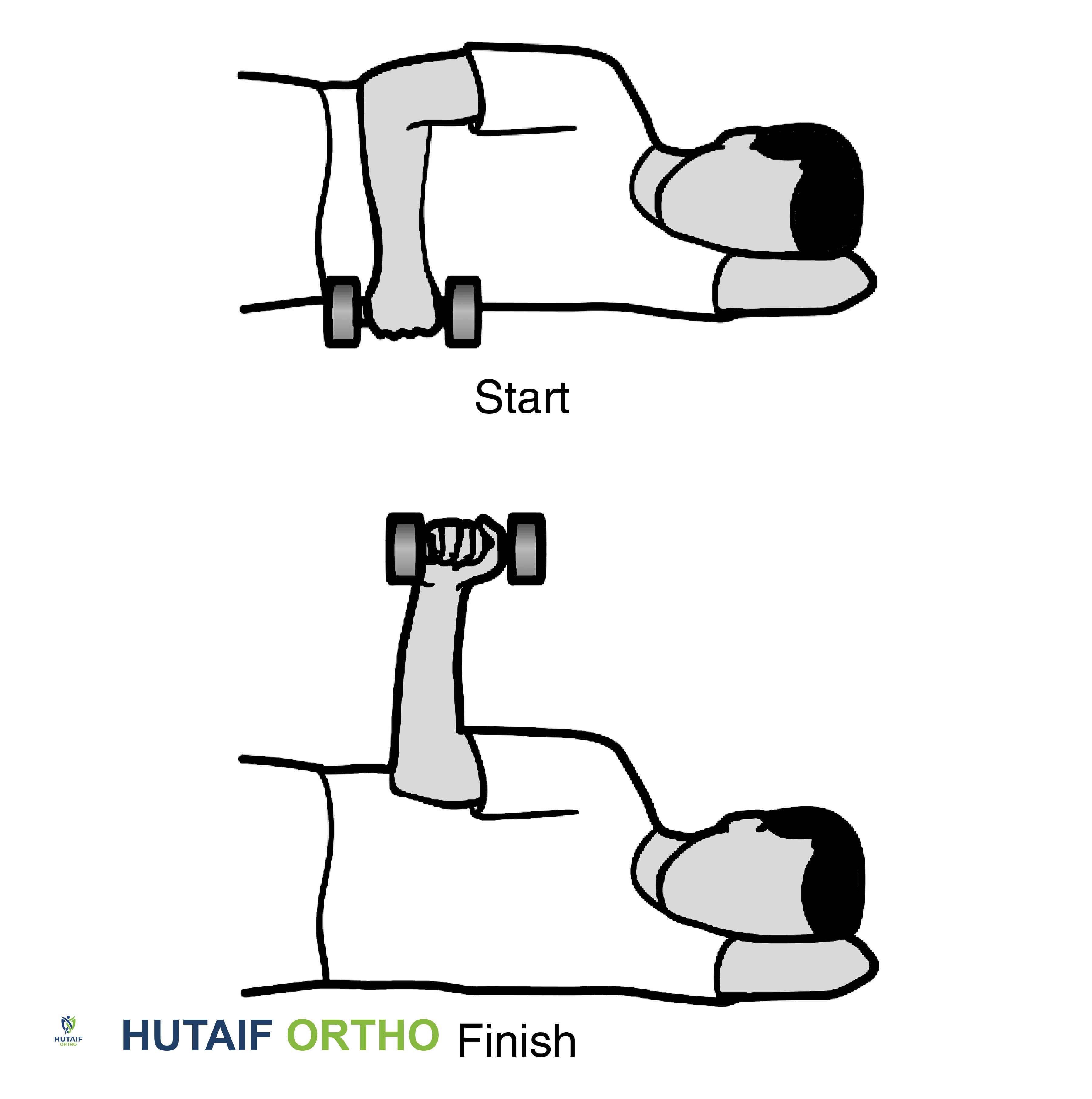 صورة طبية: تمزق الكفة المدورة بالكتف: دليلك الشامل للعلاج والتعافي مع الأستاذ الدكتور محمد هطيف في صنعاء