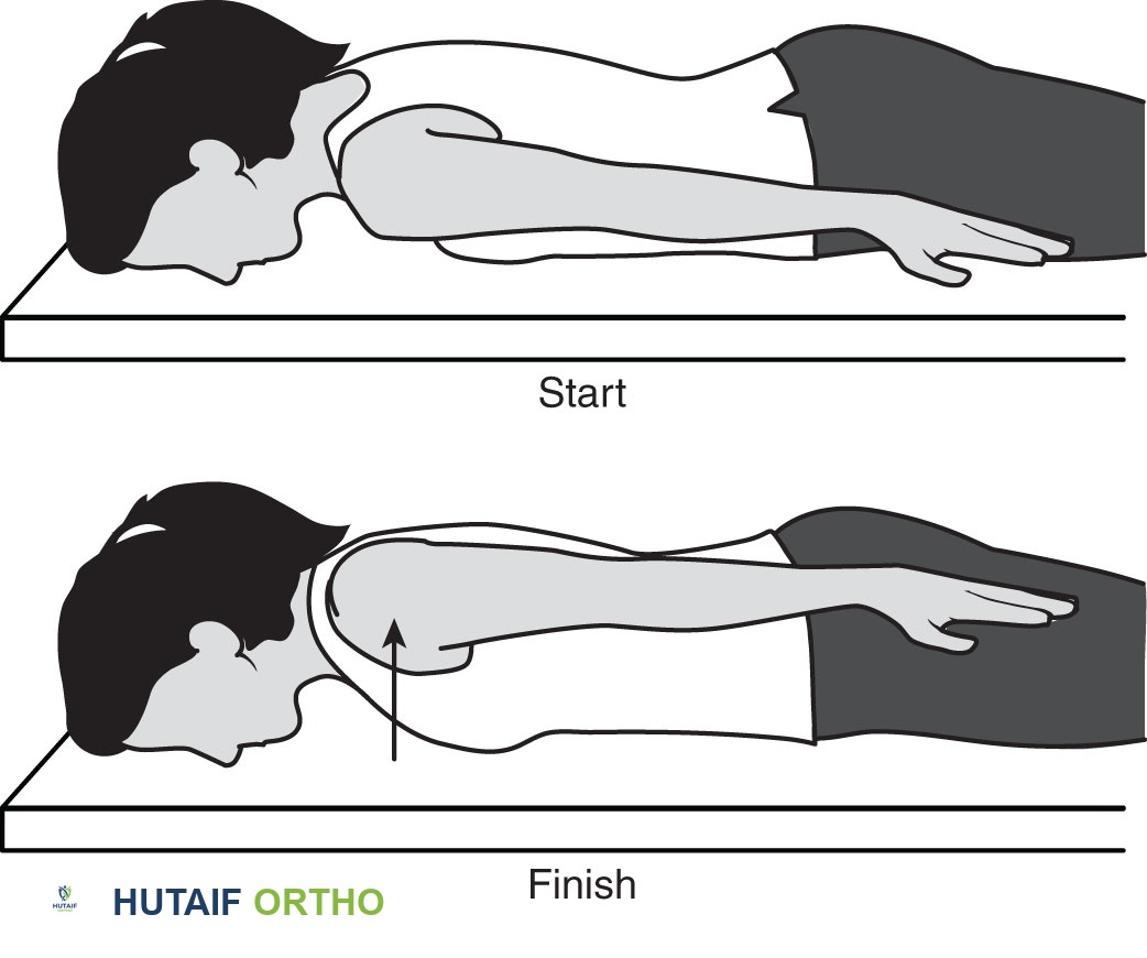 صورة طبية: تمزق الكفة المدورة بالكتف: دليلك الشامل للعلاج والتعافي مع الأستاذ الدكتور محمد هطيف في صنعاء