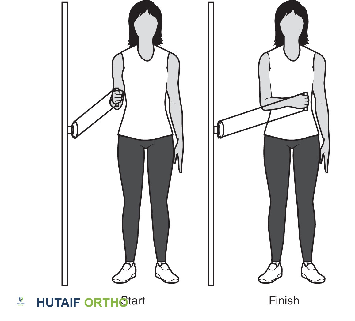 صورة طبية: تمزق الكفة المدورة بالكتف: دليلك الشامل للعلاج والتعافي مع الأستاذ الدكتور محمد هطيف في صنعاء