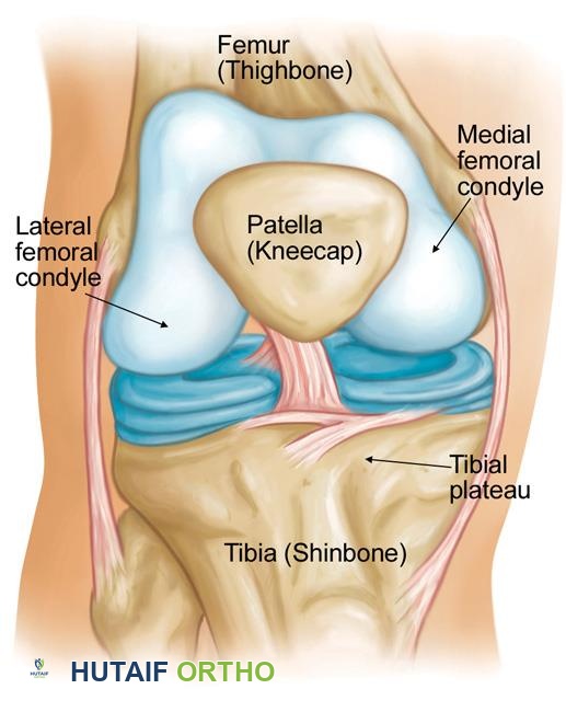 نخر عظم الركبة: دليل شامل للمرضى مع الأستاذ الدكتور محمد هطيف في صنعاء