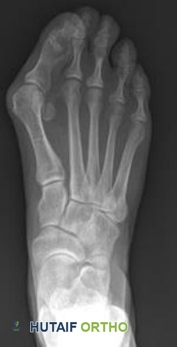 أشعة سينية للوكعة