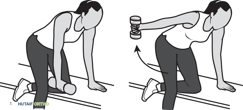 صورة طبية: تمزق الكفة المدورة بالكتف: دليلك الشامل للعلاج والتعافي مع الأستاذ الدكتور محمد هطيف في صنعاء
