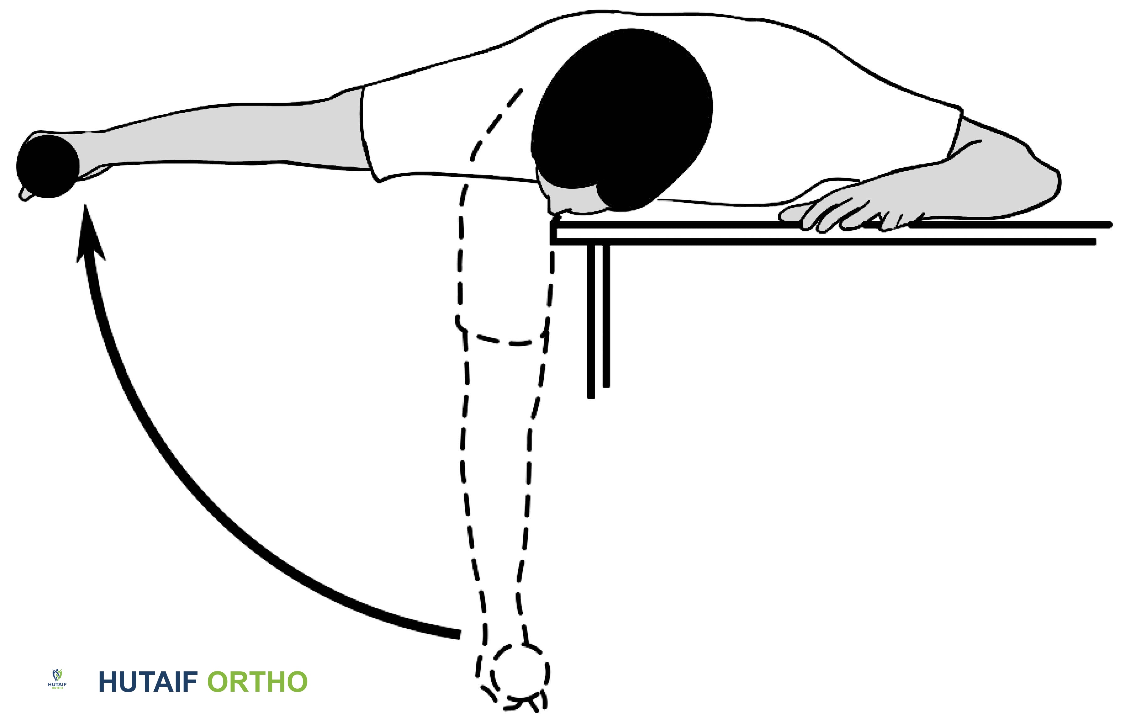 صورة طبية: تمزق الكفة المدورة بالكتف: دليلك الشامل للعلاج والتعافي مع الأستاذ الدكتور محمد هطيف في صنعاء