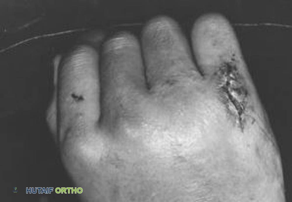 لدغات الإنسان: دليل شامل للوقاية والعلاج مع الأستاذ الدكتور محمد هطيف