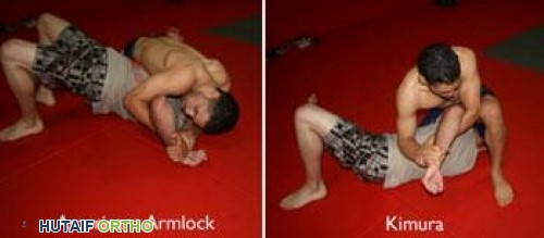 الوقاية من إصابات الفنون القتالية: دليلك الشامل لتدريب آمن وفعال