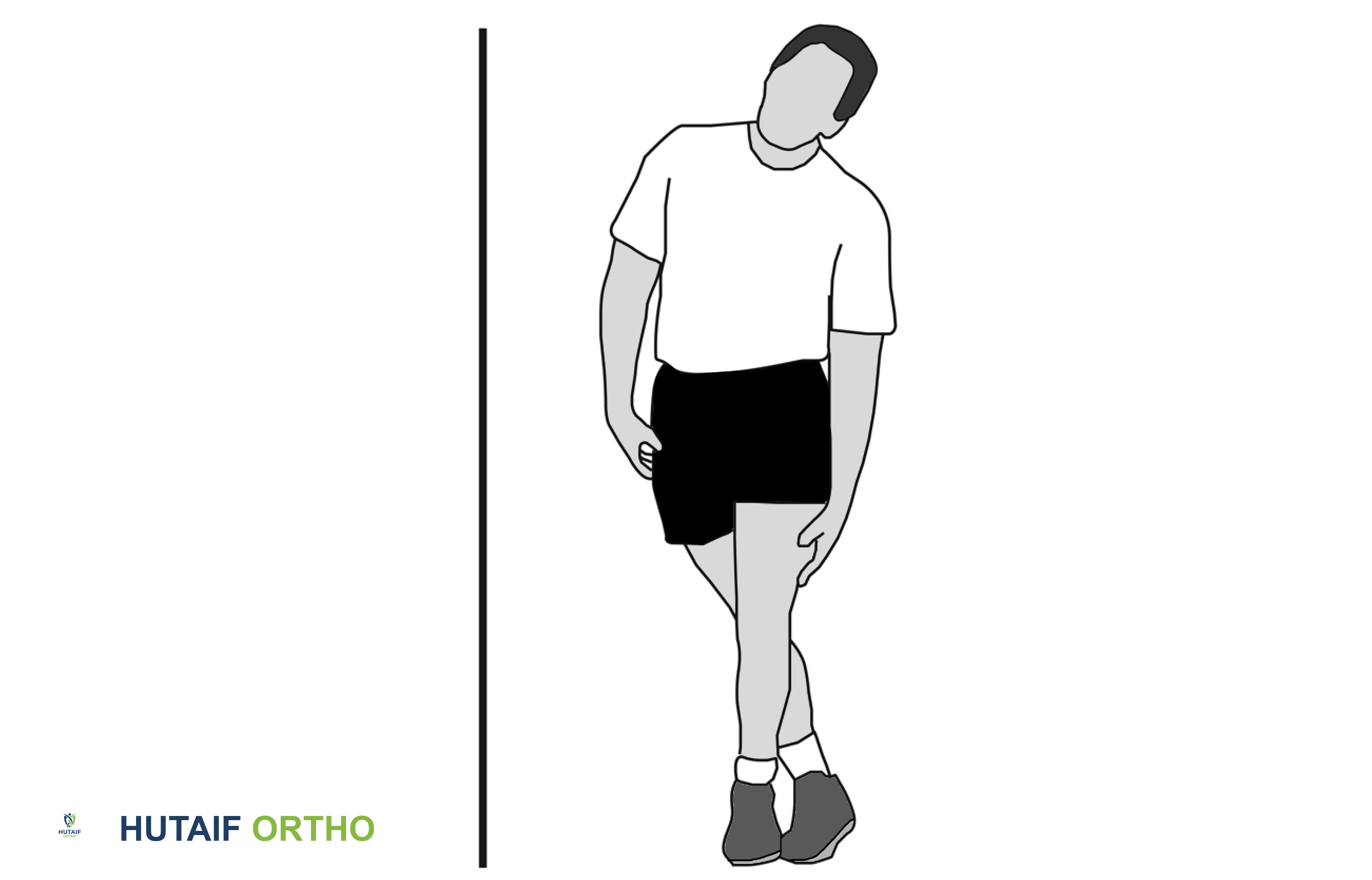 صورة توضيحية لـ برنامج تأهيل وتقوية الورك: دليل شامل من الأستاذ الدكتور محمد هطيف