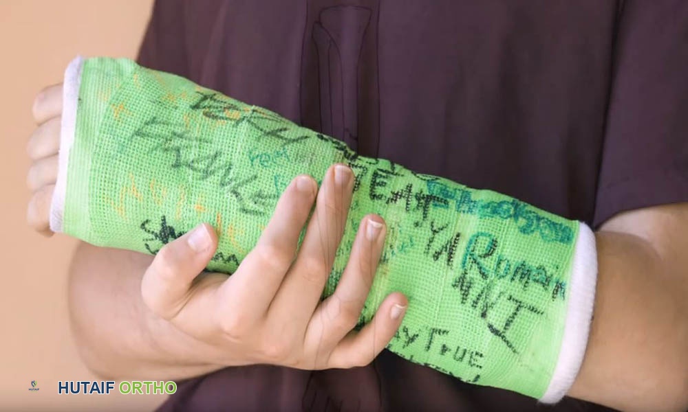 حول الجبائر