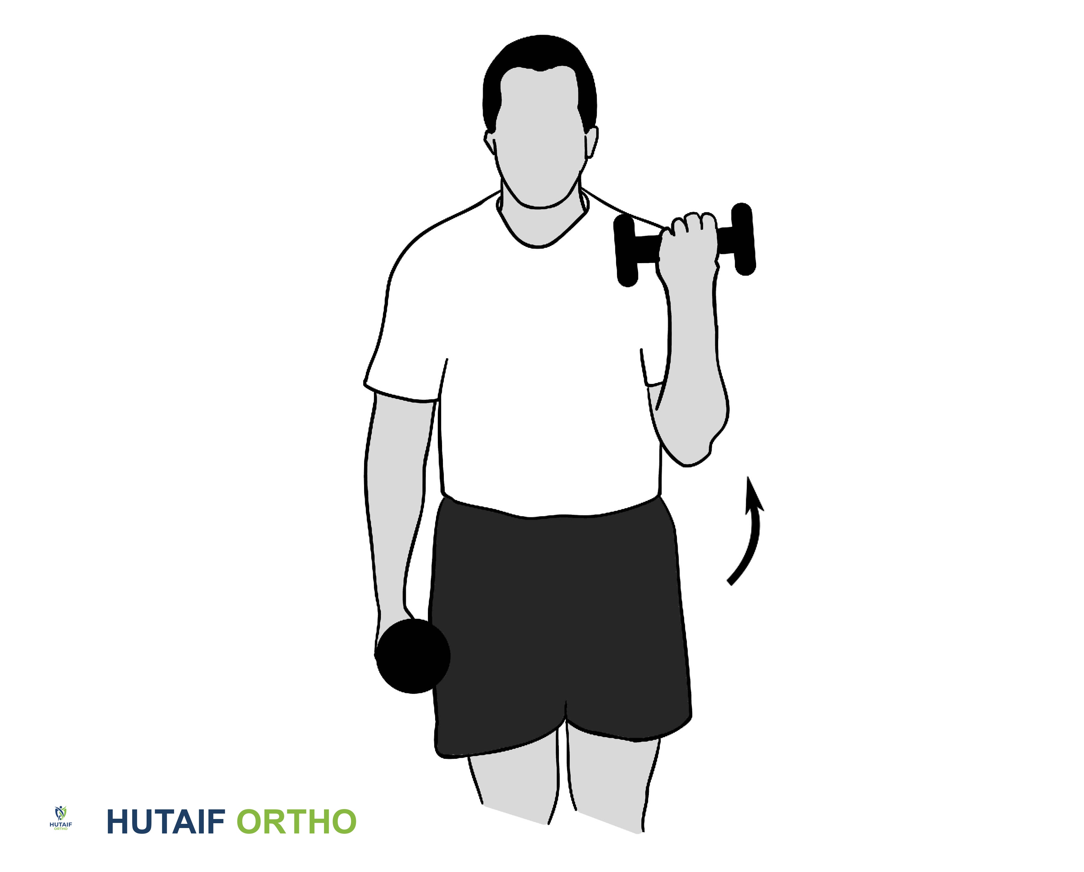 صورة طبية: تمزق الكفة المدورة بالكتف: دليلك الشامل للعلاج والتعافي مع الأستاذ الدكتور محمد هطيف في صنعاء