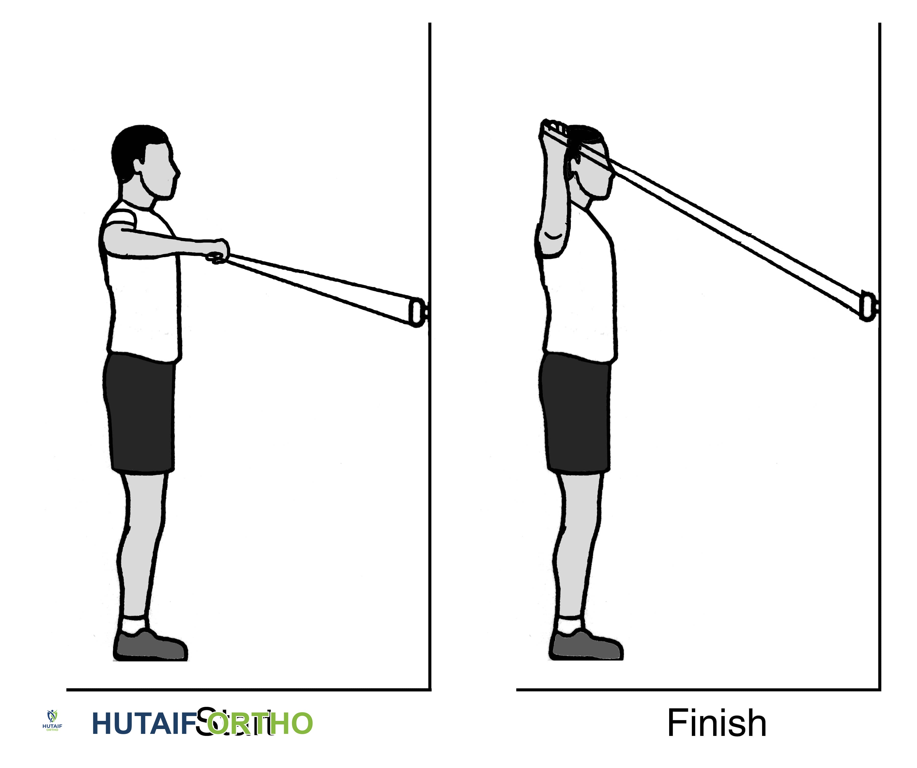 صورة طبية: برنامج شامل لتقوية وتأهيل الكتف والكفة المدورة: دليلك للتعافي مع الأستاذ الدكتور محمد هطيف