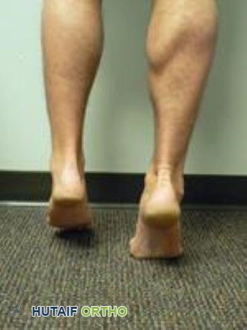 رفع الكعب بساق واحدة