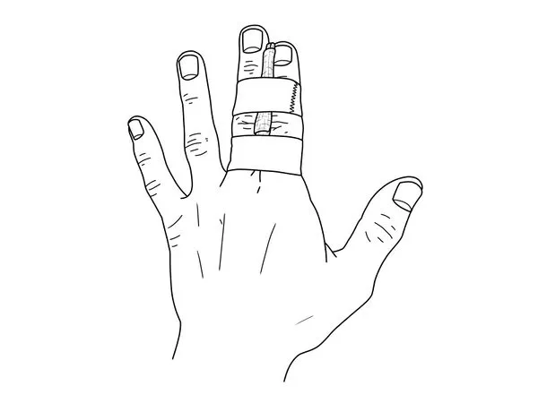 Buddy Taping Finger Wrap