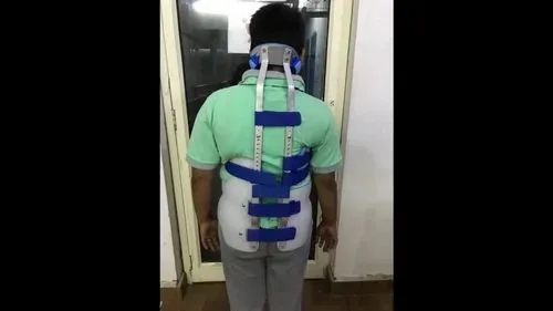 Boston Brace (Scoliosis)