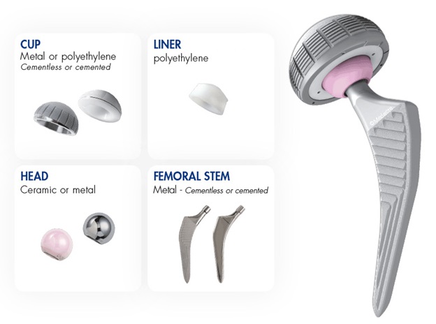 مفصل ورك معدني وبلاستيكي يُستخدم في جراحة استبدال مفصل الورك