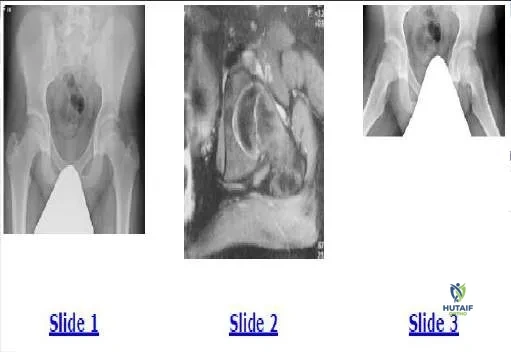 Orthopedic Prometric MCQs - Chapter 3 Part 19