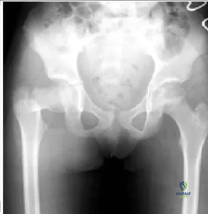 Orthopedic Prometric MCQs - Chapter 3 Part 20