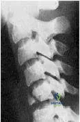 Orthopedic Prometric Exam Chapter 3 Image
