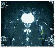 Orthopedic Prometric Exam Chapter 3 Image