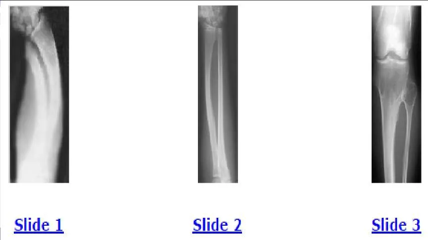 Orthopedic Prometric Exam Preparation MCQs - Part 10