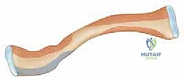 Mastering Shoulder Anatomy: An Intraoperative Surgical Approach & Pearls