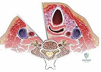 مناظير 4K في جراحة العمود الفقري