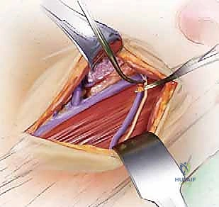 أفضل دكتور عمود فقري في اليمن الدكتور محمد هطيف