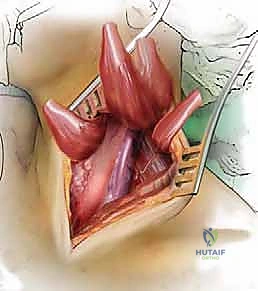 ارتداء طوق الرقبة الطبي