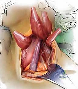 الوقاية من مشاكل الرقبة المستقبلية