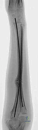 Clinical Image