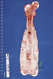 دراسة العوامل الوراثية