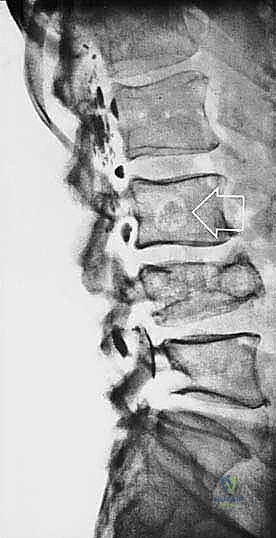 Clinical Image