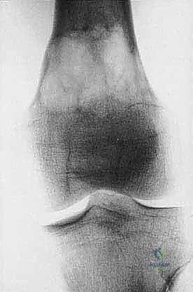 الدعم النفسي للمريض