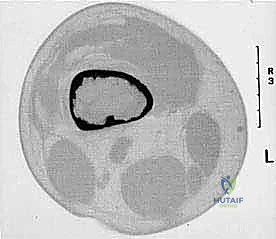 الفريق الطبي متعدد التخصصات