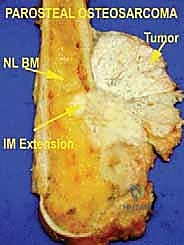 الهوامش الجراحية