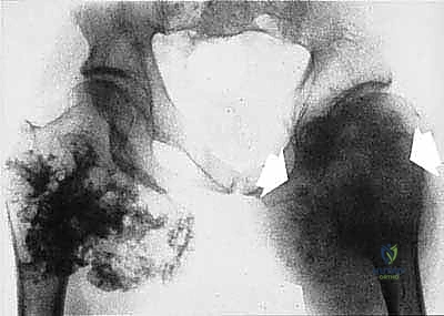 غرفة العمليات