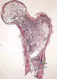 الحفاظ على الأعصاب