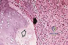 صورة طبية: دليل شامل لاستئصال الساركوما: فهم البيولوجيا، تحديد المراحل، ومبادئ الحفاظ على الأطراف مع الأستاذ الدكتور محمد هطيف