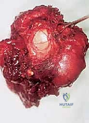 الطعوم العظمية