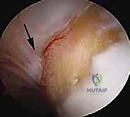تجهيز المريض ووضعية الجراحة