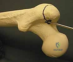 استخدام جهاز الأشعة C-arm
