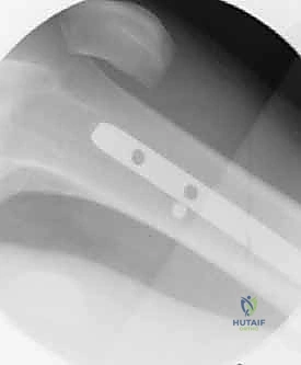 العلاج الطبيعي والتأهيل